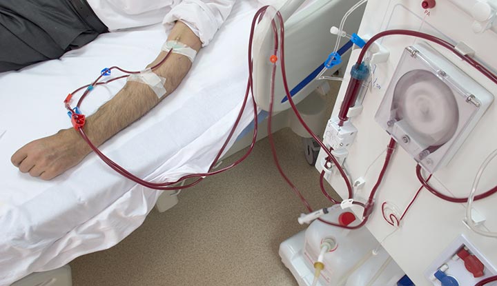 Dialysis Treatment