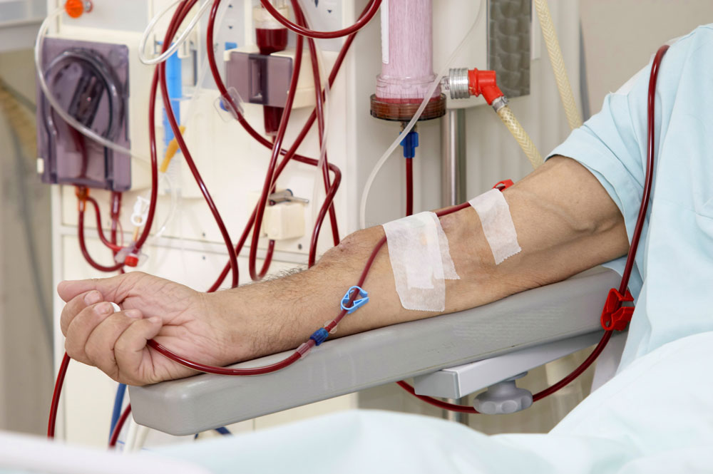BEST DIALYSIS TREATMENT