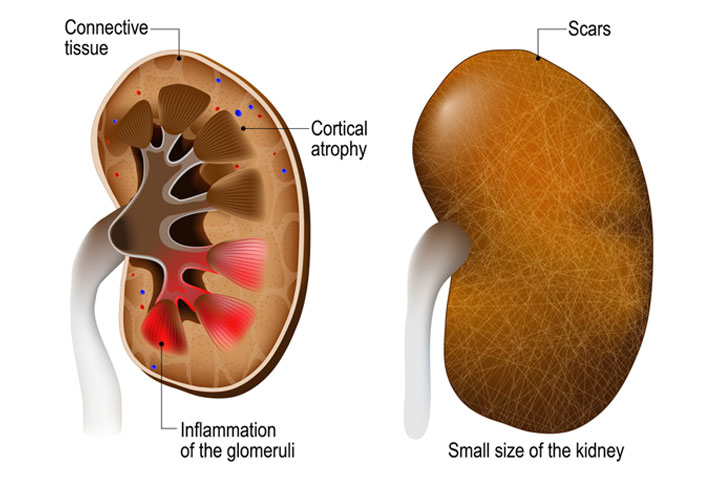 Best Nephrologist