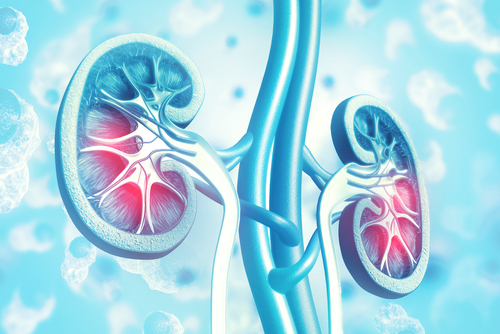 KIDNEY TRANSPLANT DOCTOR